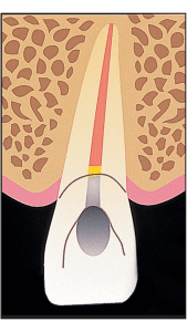 19-10---ULTRADENT
