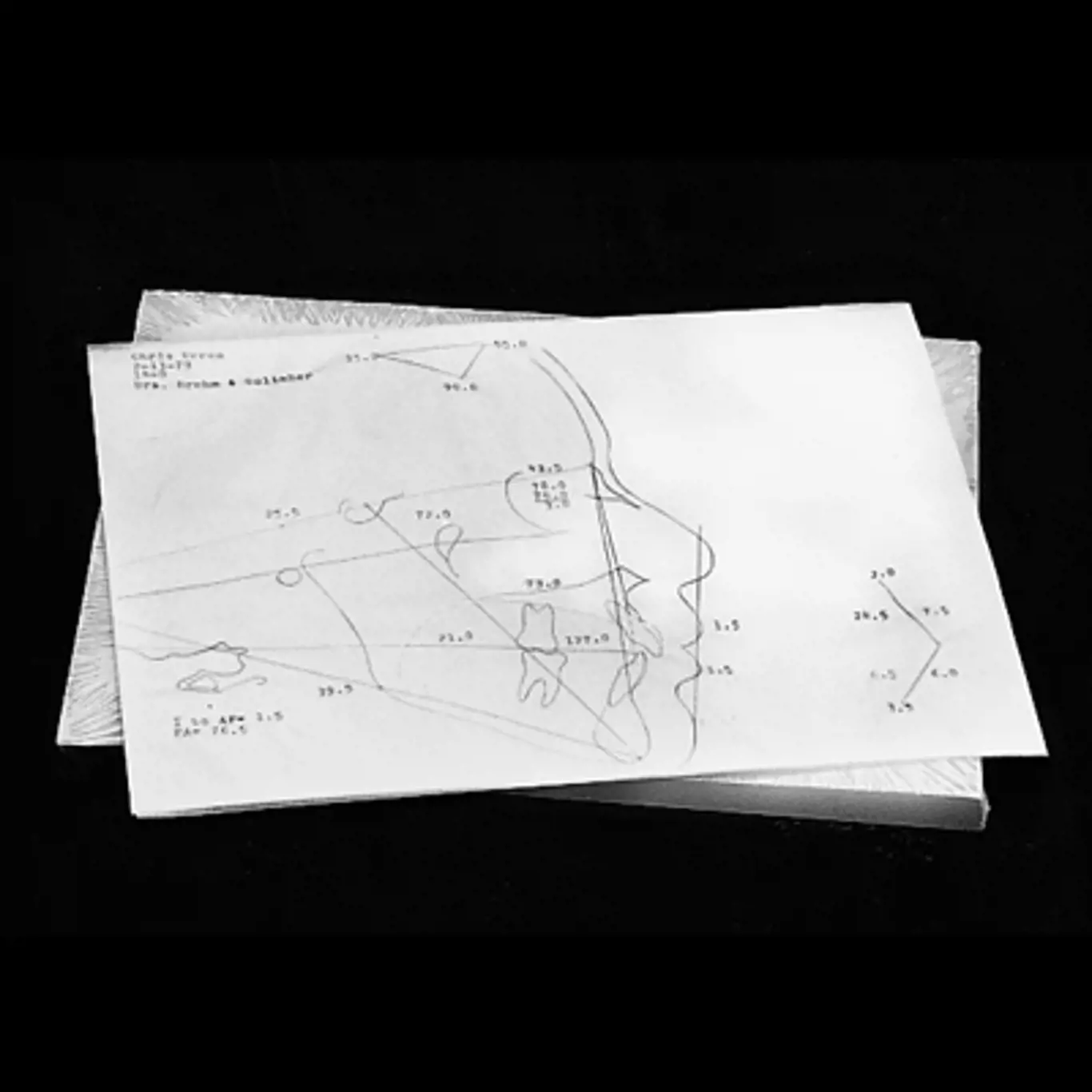 Mua Giấy Vẽ Đo Sọ Chuyên Dụng Ceph Tracing Paper ️ Giá Rẻ Nhất【FREESHIP】