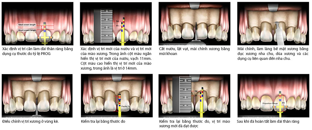 Thuoc do tham my dr Chu 8