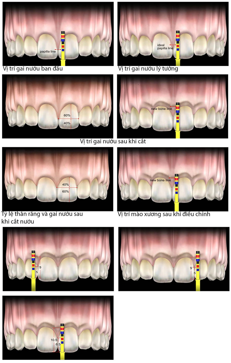 Thuoc do tham my dr Chu 10