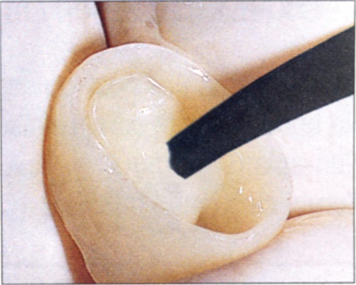 144-3-Permaflor-ULTRADENT