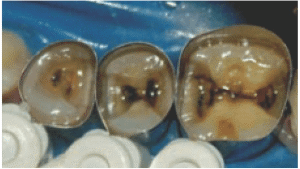 51-10-Omni-matrix-ULTRADENT