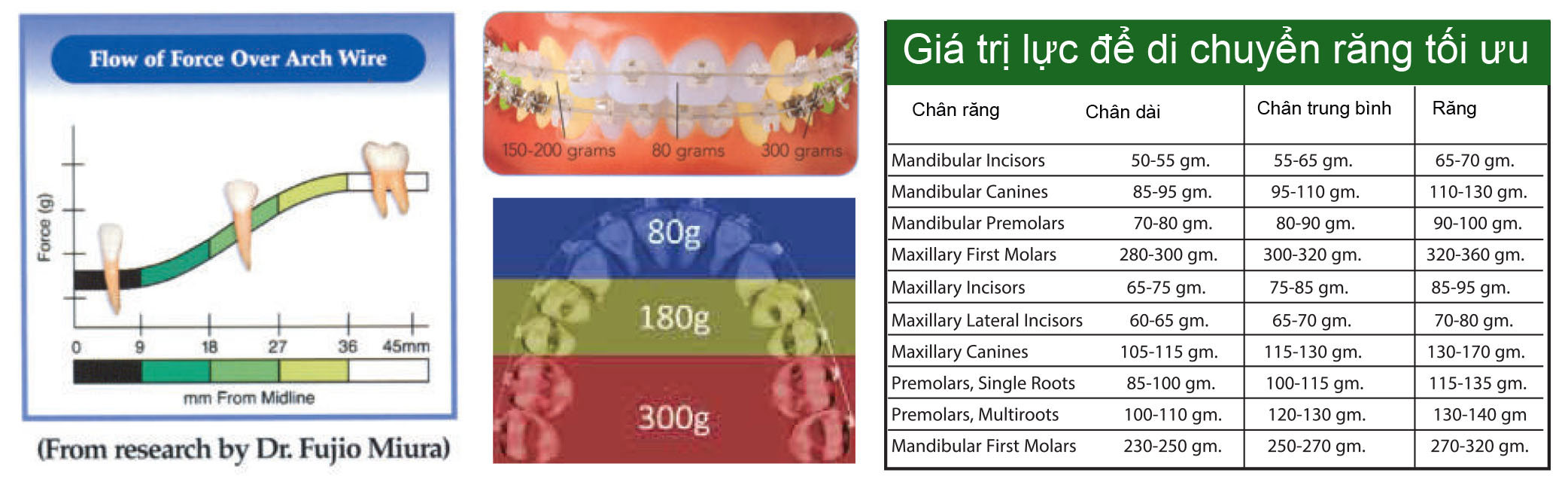 Bioforce Sentalloy 1