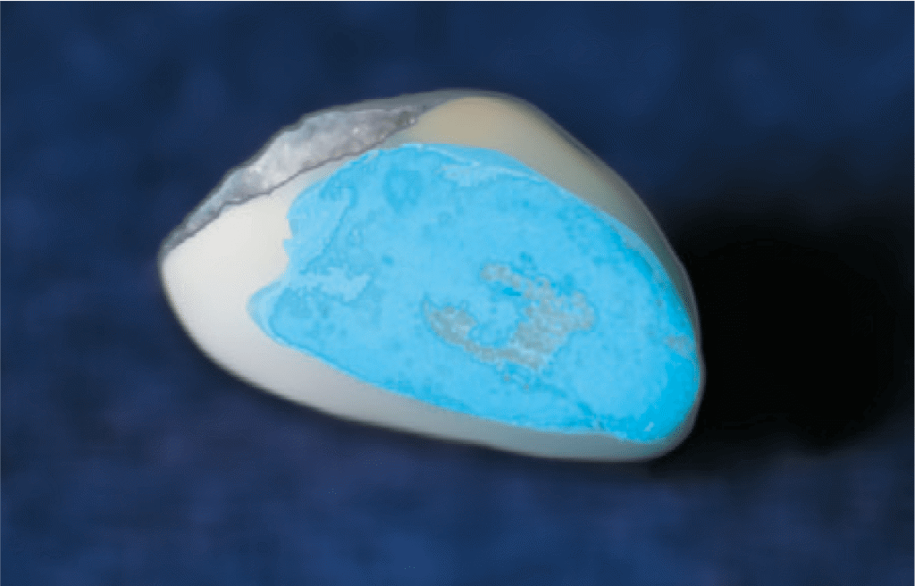 41-11-hisite-ULTRADENT