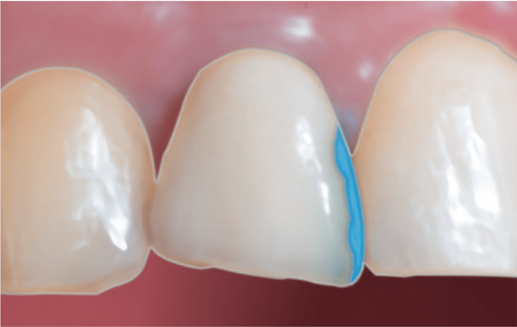 41-10-hisite-ULTRADENT