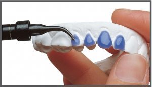 21-5-lc-block-out-ULTRADENT