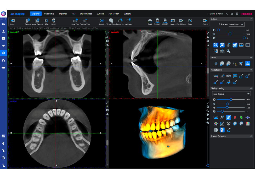 Planmeca-cbct-planning