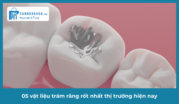 Top 5 vật liệu trám răng tốt nhất hiện nay: So sánh chi tiết và cách lựa chọn phù hợp