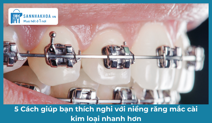5 Cách Giúp Bạn Thích Nghi Với Niềng Răng Mắc Cài Kim Loại Nhanh Hơn