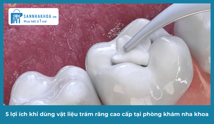 5 lợi ích khi dùng vật liệu trám răng cao cấp tại phòng khám nha khoa