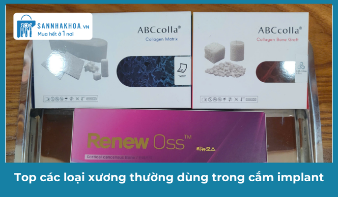 Top các loại xương thường dùng trong cắm implant