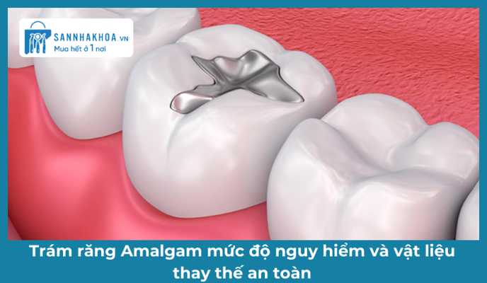Trám răng Amalgam mức độ nguy hiểm và vật liệu thay thế an toàn