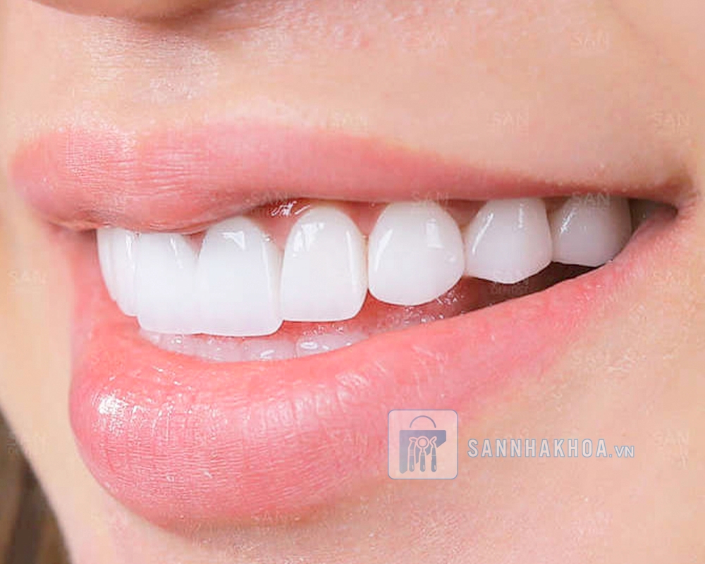 Mài răng bọc sứ sai cách: Tác hại và những thông tin cần biết