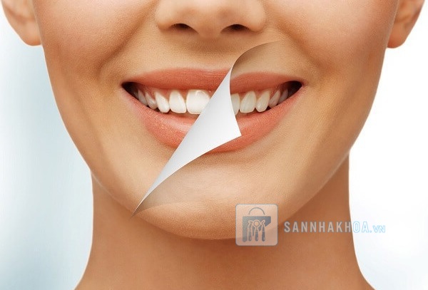 Bật mí các phương pháp tẩy trắng răng: Bạn đã chọn đúng cách?