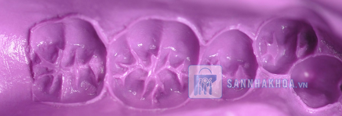 Cách sử dụng cao su đặc an toàn trong nha khoa