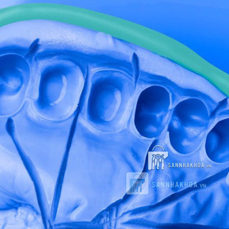 Cao su đặc lấy dấu răng là gì?