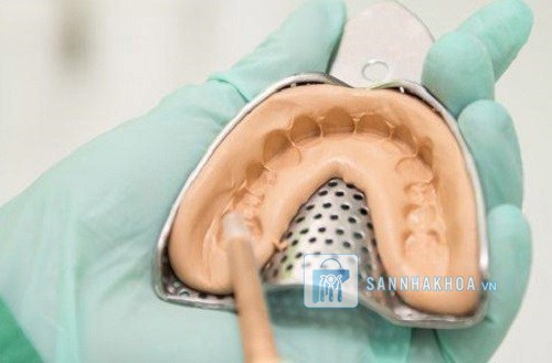 Các lưu ý khi sử dụng cao su đặc lấy dấu răng