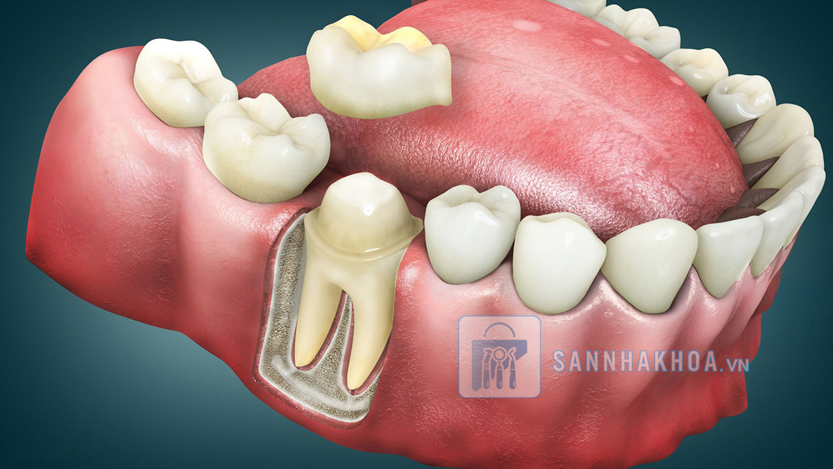 Dịch vụ thẩm mỹ – bảo vệ – cải thiện hình thể răng