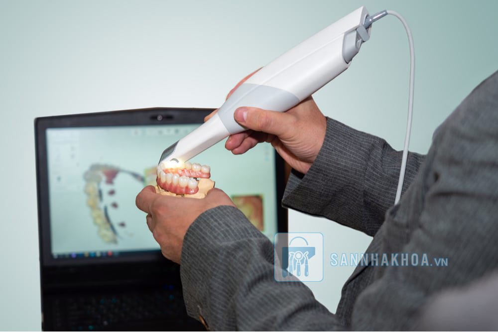 Máy lấy dấu kỹ thuật số hoạt động như thế nào?