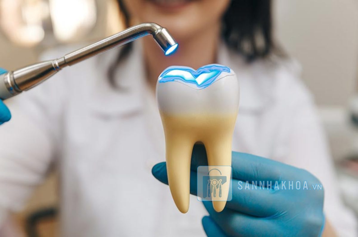 Tiêu chí chọn mua đèn trá răng chất lượng