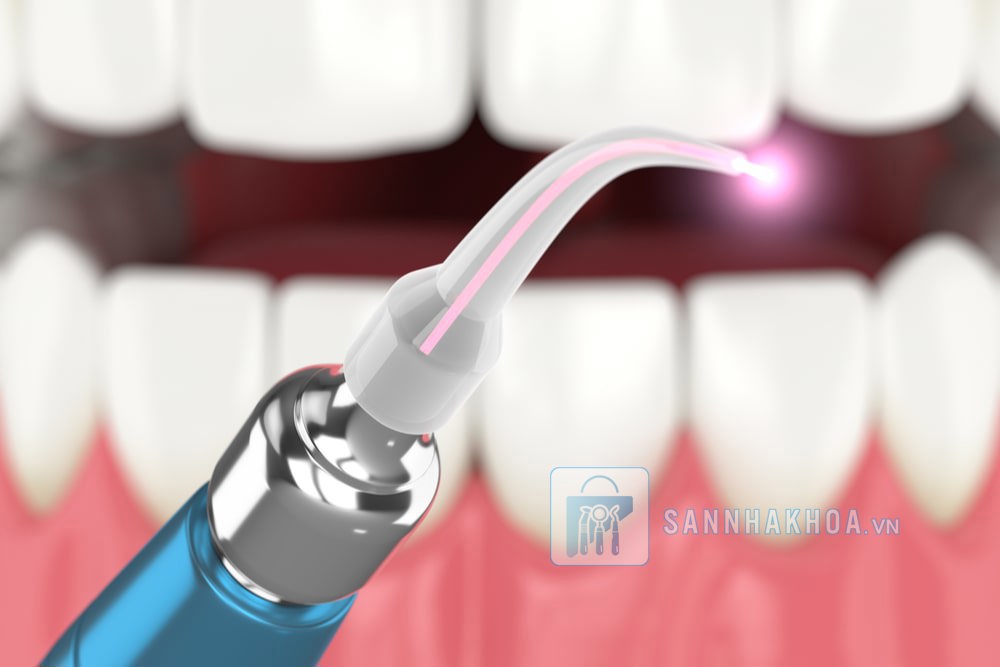 Ứng Dụng Của Máy Laser Nha Khoa Trong Thẩm Mỹ Nha Khoa