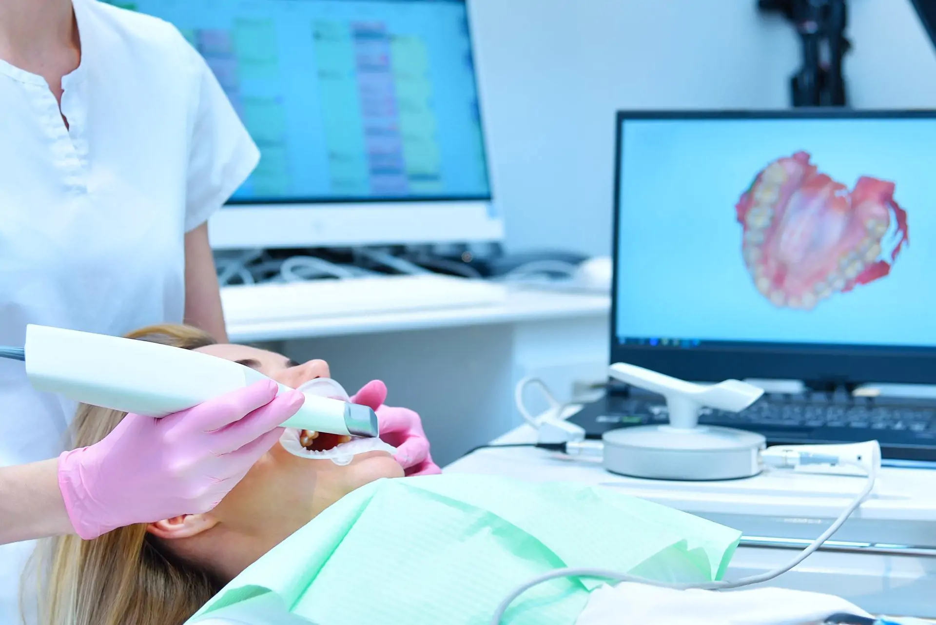 Máy scan dấu răng (Intraoral Scanner) có thực sự cần thiết?