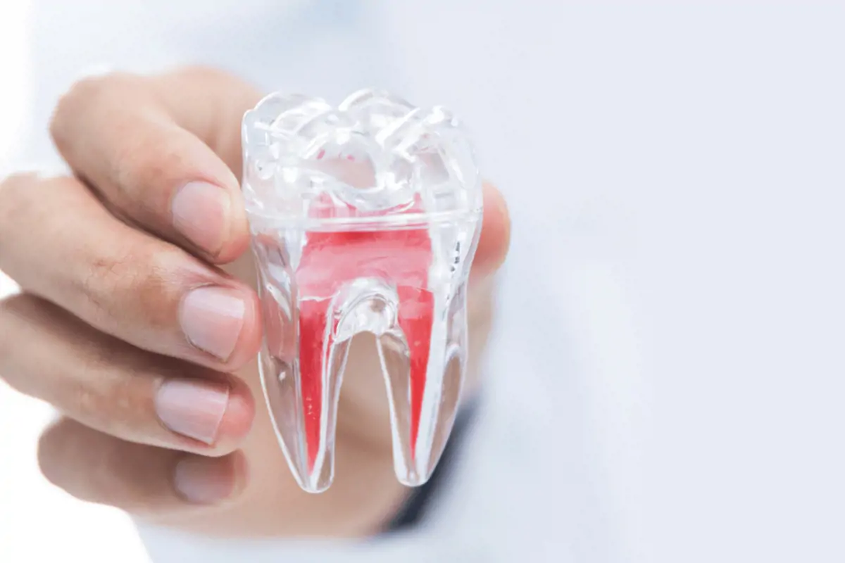 Trâm nội nha (trâm trám ống tủy): Trâm tay và trâm máy