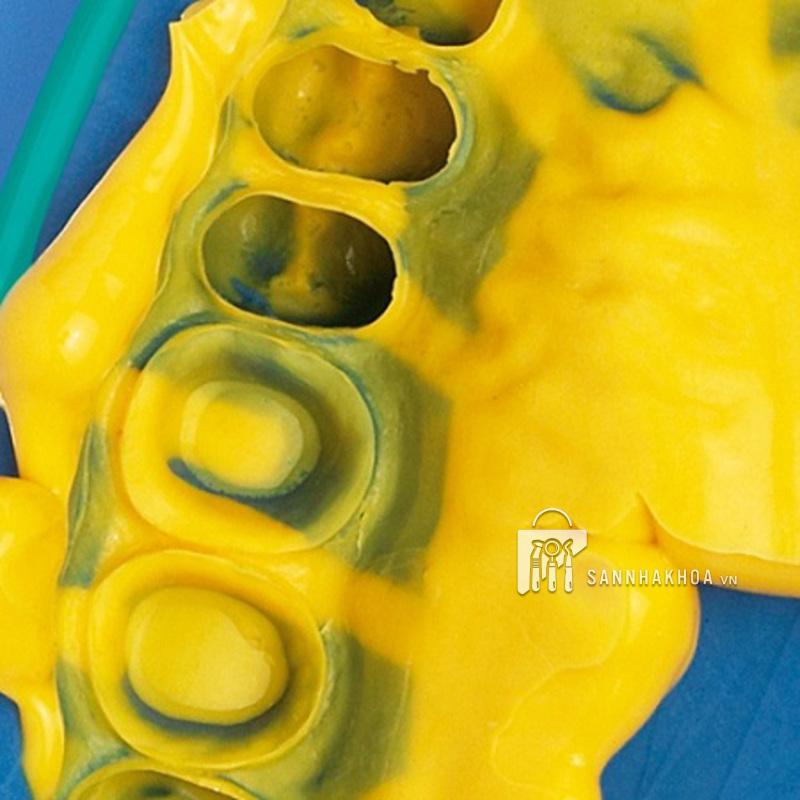 cao su đặc lấy dấu - ảnh sản phẩm thực tế