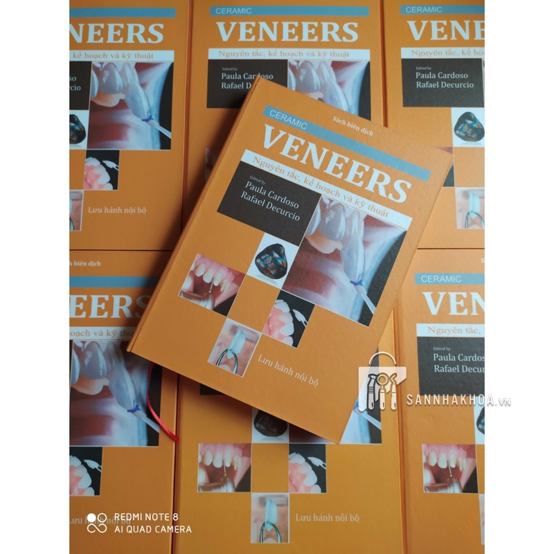 veneer nguyên tắc - ảnh sản phẩm thực tế