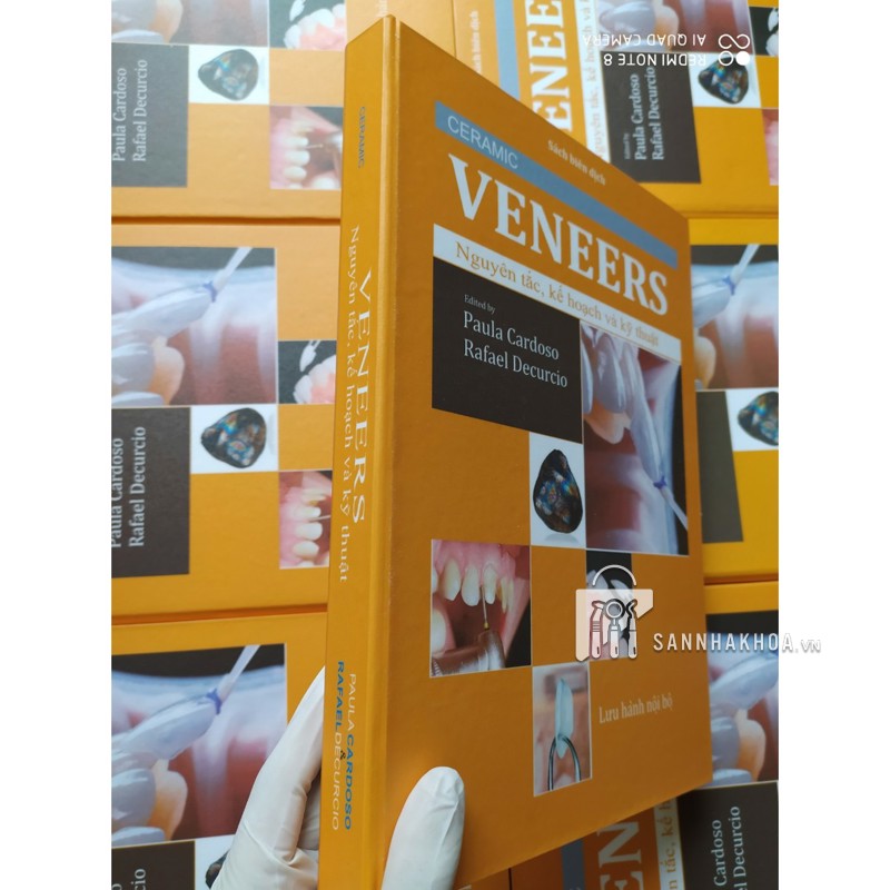 Veneer - Nguyên tắc kế hoạch và kỹ thuật - ảnh sản phẩm thực tế