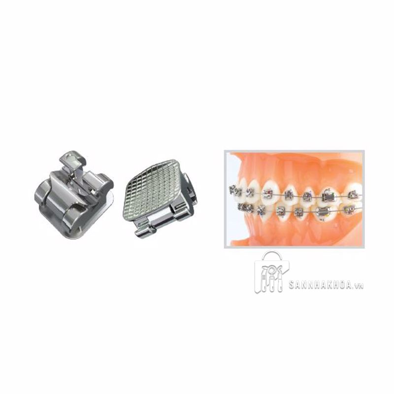 bộ kit mắc cài chỉnh nha - ảnh sản phẩm thực tế