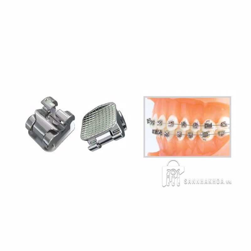 bộ kit mắc cài chỉnh nha rose - ảnh sản phẩm thực tế