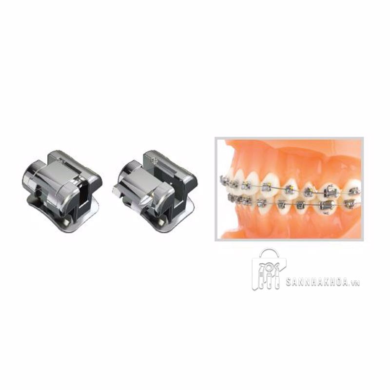 bộ kit mác cài chỉnh nha kim loại - ảnh sản phẩm thực tế