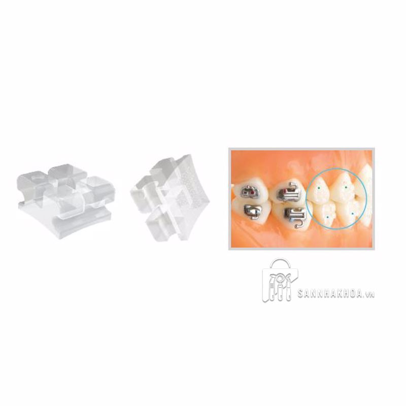 bộ mắc cài chỉnh nha - ảnh sản phẩm thực tế