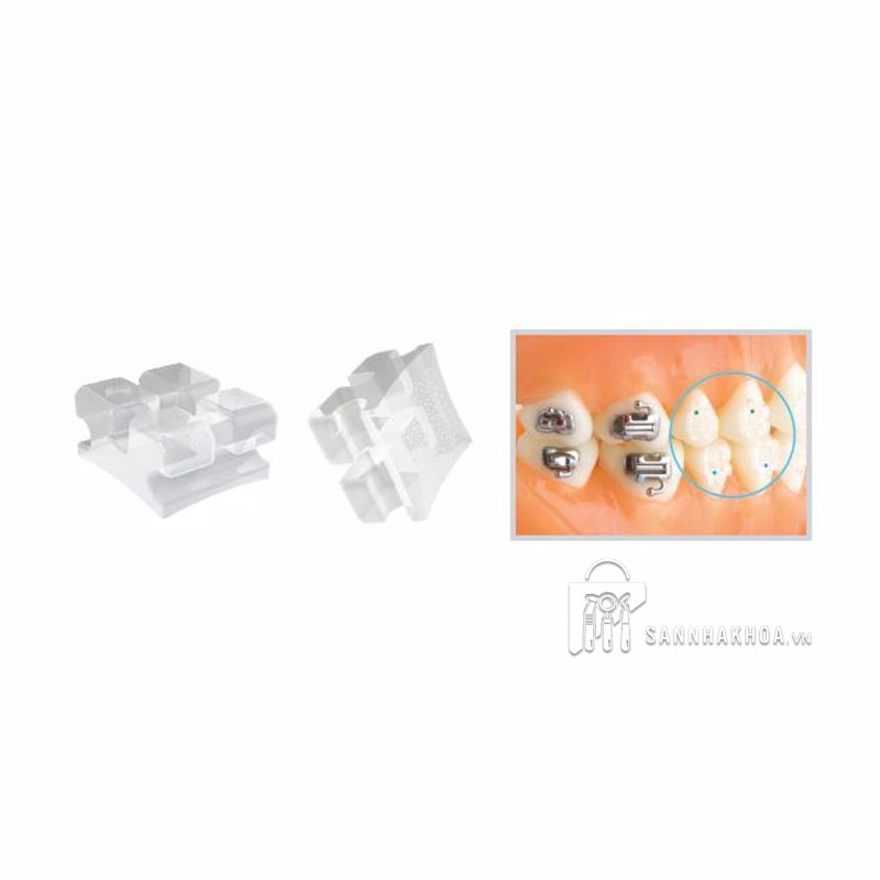 bộ kit mắc cài chỉnh nha - ảnh sản phẩm thực tế