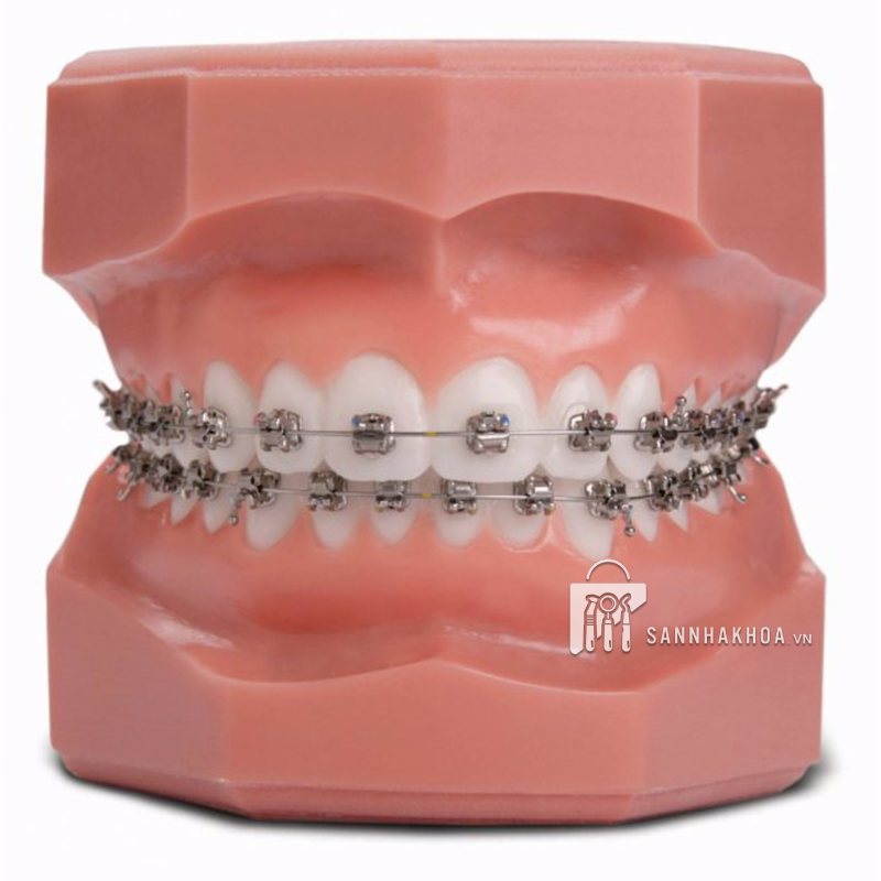 mắc cài tự buộc 3m - ảnh sản phẩm thực tế