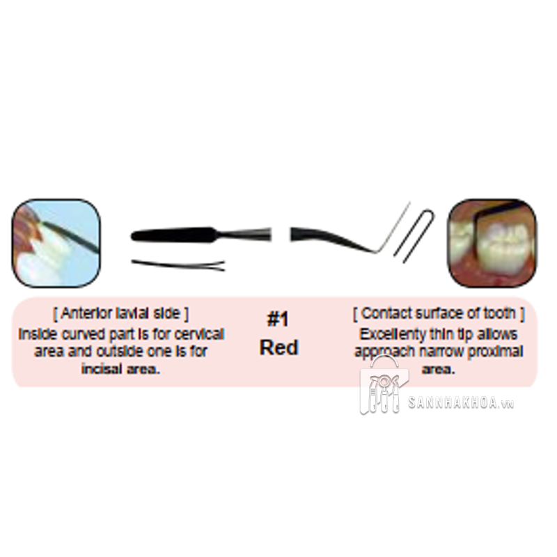 composite trám - ảnh sản phẩm thực tế