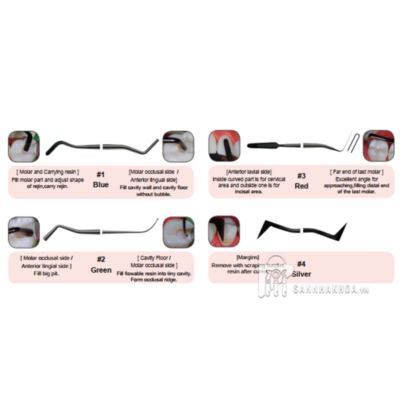 composite trám - ảnh sản phẩm thực tế