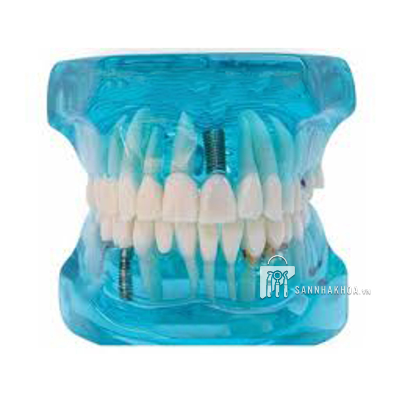 Mẫu hàm tư vấn bệnh lý 5 trong 1