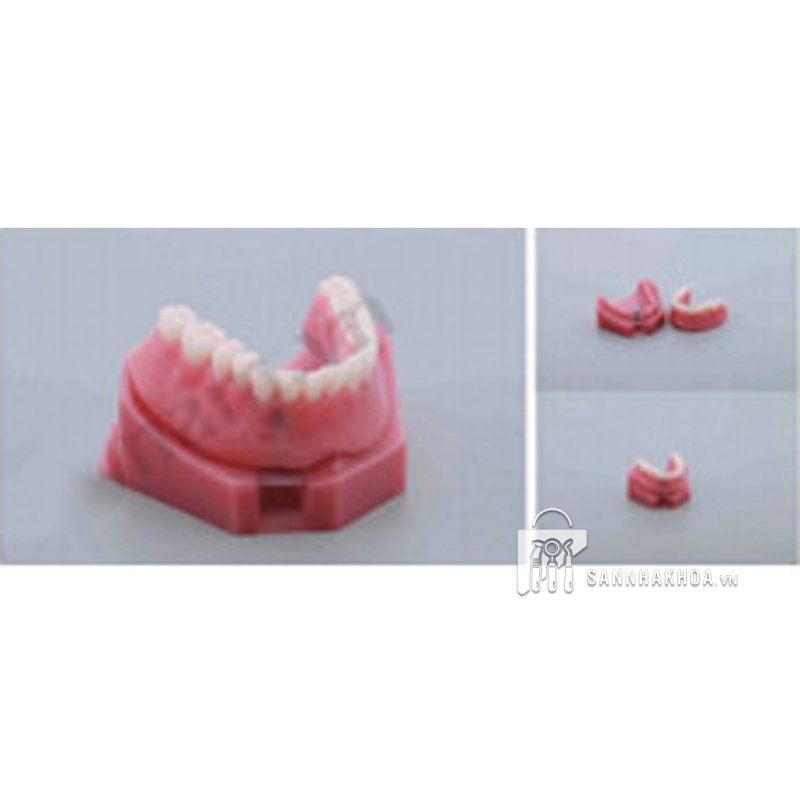 bộ tháo implant - ảnh sản phẩm thực tế