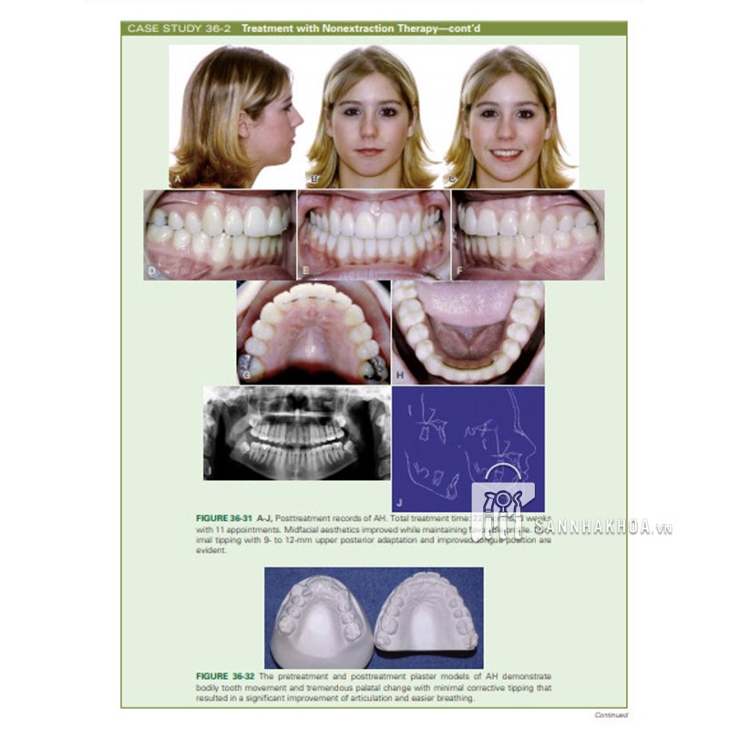 Orthodontics: Current Principles and Techniques - ảnh sản phẩm thực tế