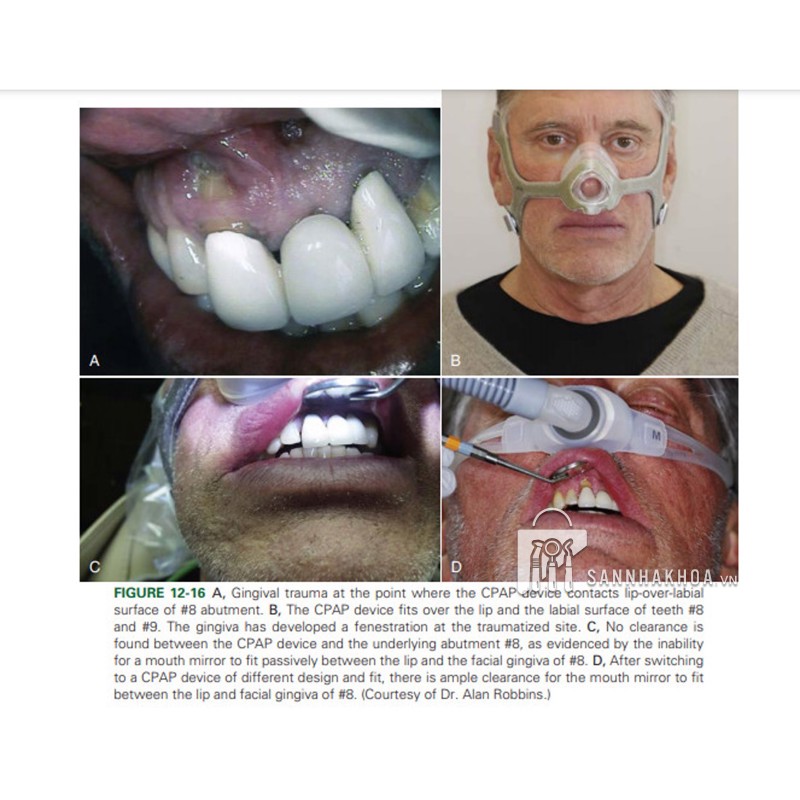 Orthodontics: Current Principles and Techniques - ảnh sản phẩm thực tế