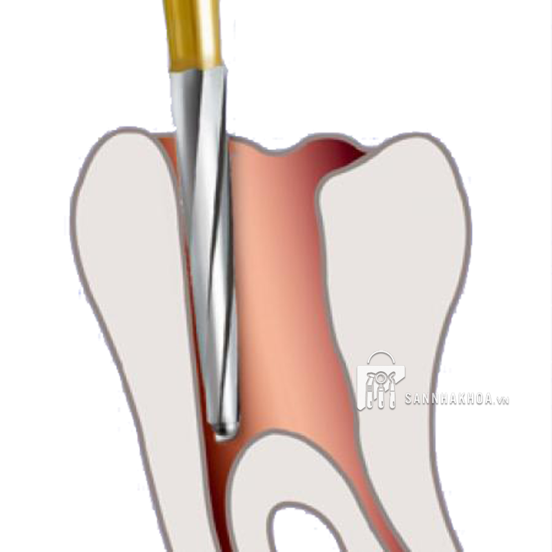 mũi mở tủy endo - ảnh sản phẩm thực tế mũi mở tủy endo - ảnh sản phẩm thực tế