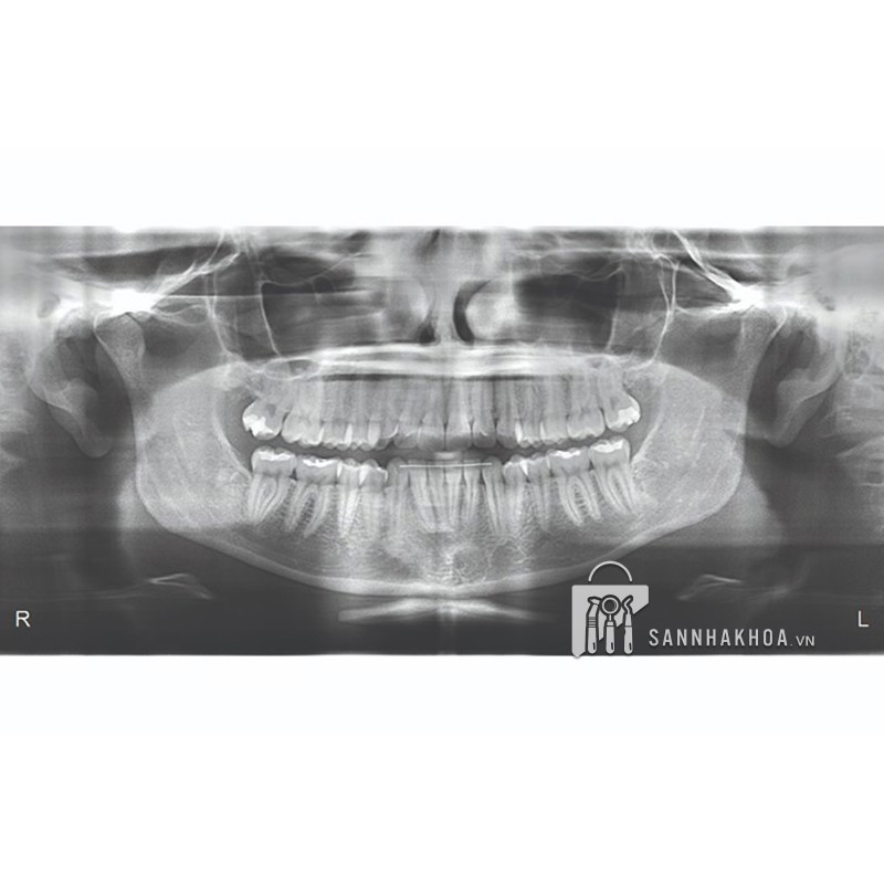 x quang nha khoa nomad pro 2 (máy x-quang cầm tay nomad pro 2) kavo dental technology - ảnh sản phẩm thực tế