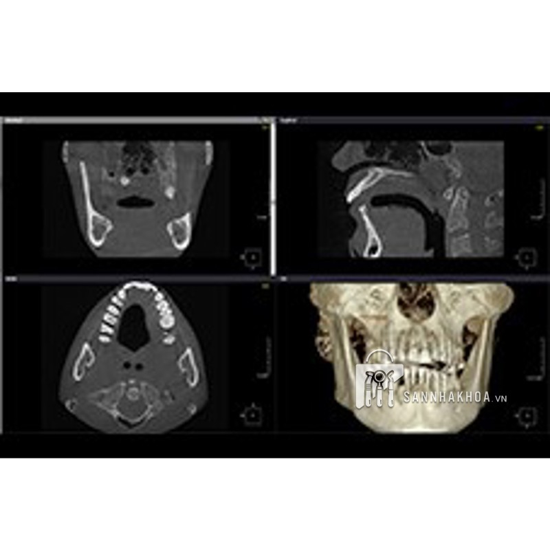 Máy chụp CT KaVo OP 3D Vision Kavo dental technology - ảnh sản phẩm thực tế