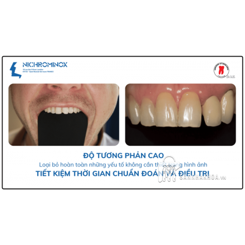 banh vạt miệng - ảnh sản phẩm thực tế