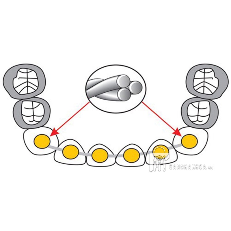 dây cung mặt lưỡi - ảnh sản phẩm thực tế