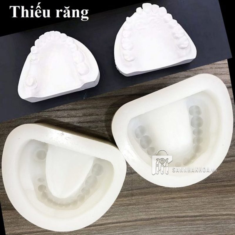 hộp đựng mẫu hàm - ảnh sản phẩm thực tế