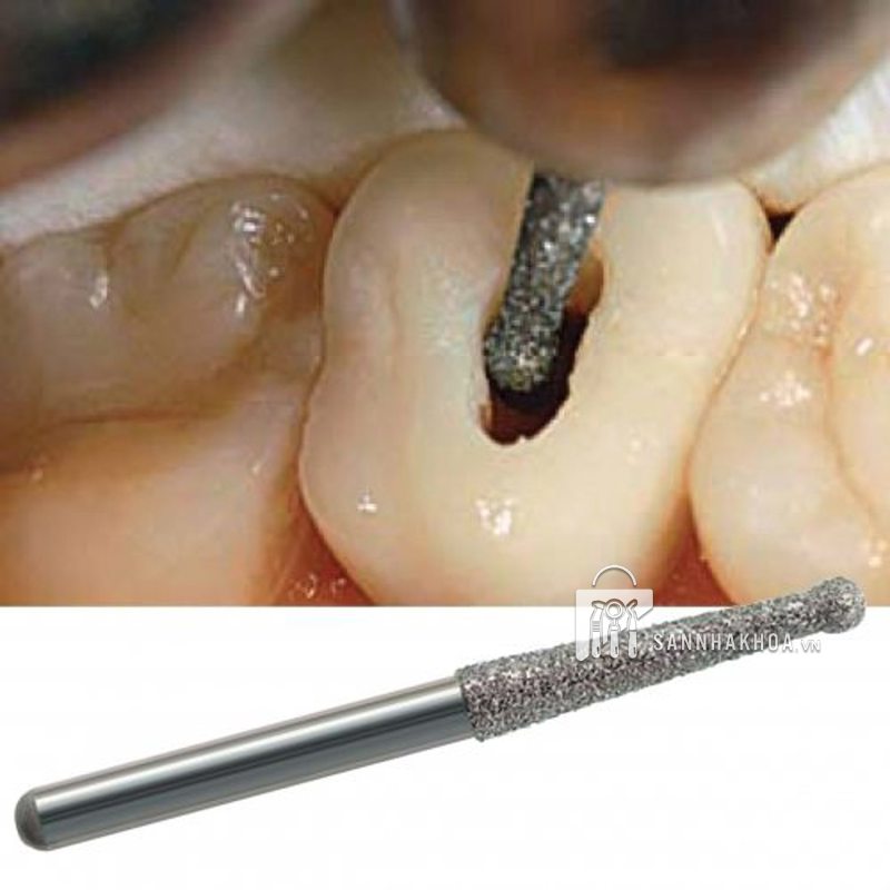 Mũi nội nha Endodontics