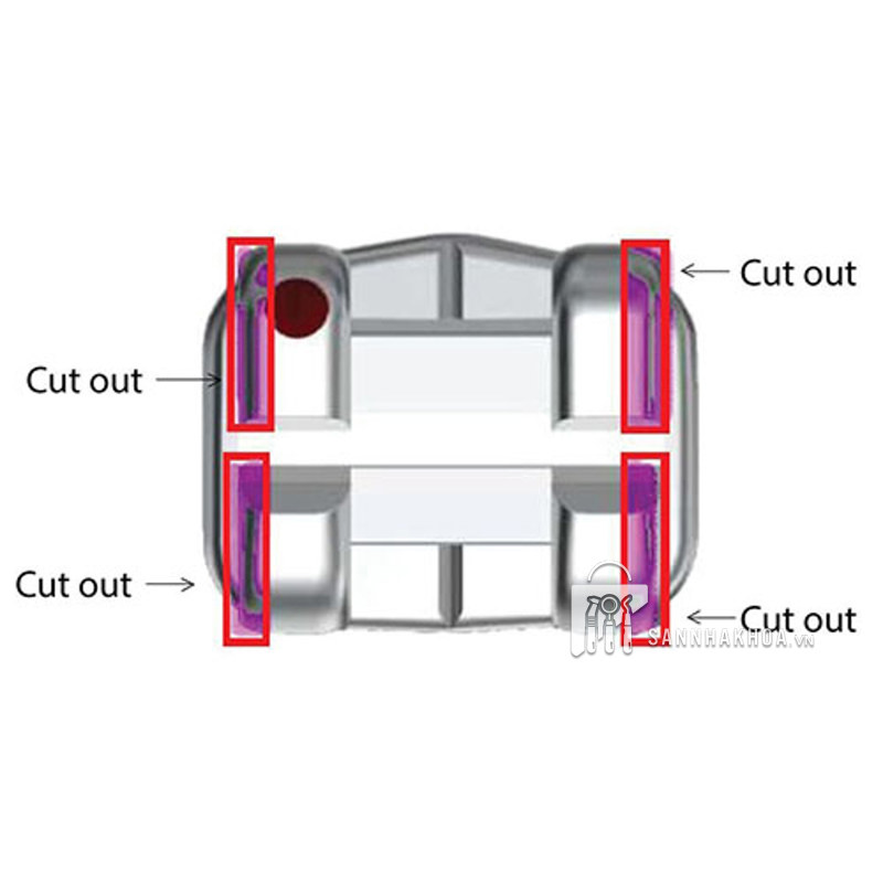 Niềng răng thẩm mỹ Mini Omni Arch